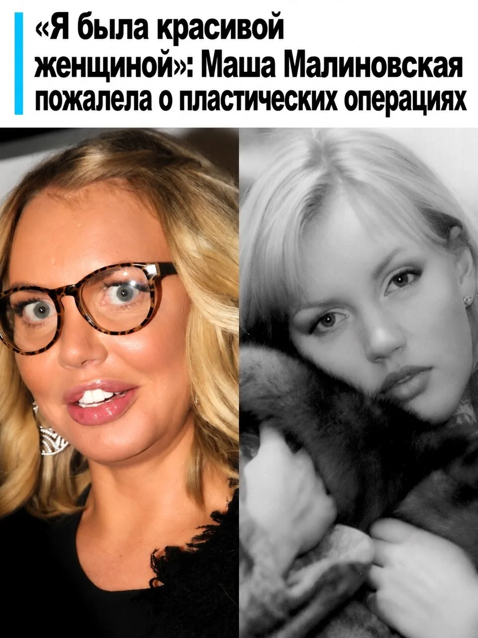 Маша Малиновская пожалела о пластических операциях: "Я была красивой женщиной".
