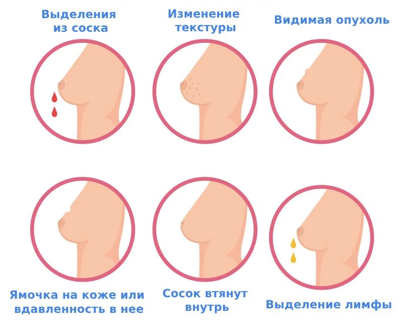 🎗 Рак молочной железы: это касается каждого