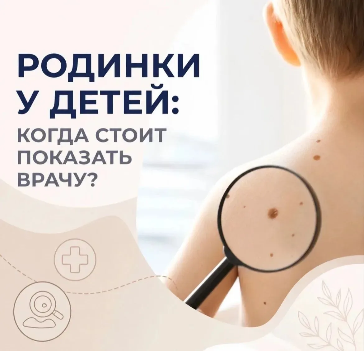 ❓Родинки у детей: когда стоит показать врачу? 🔍