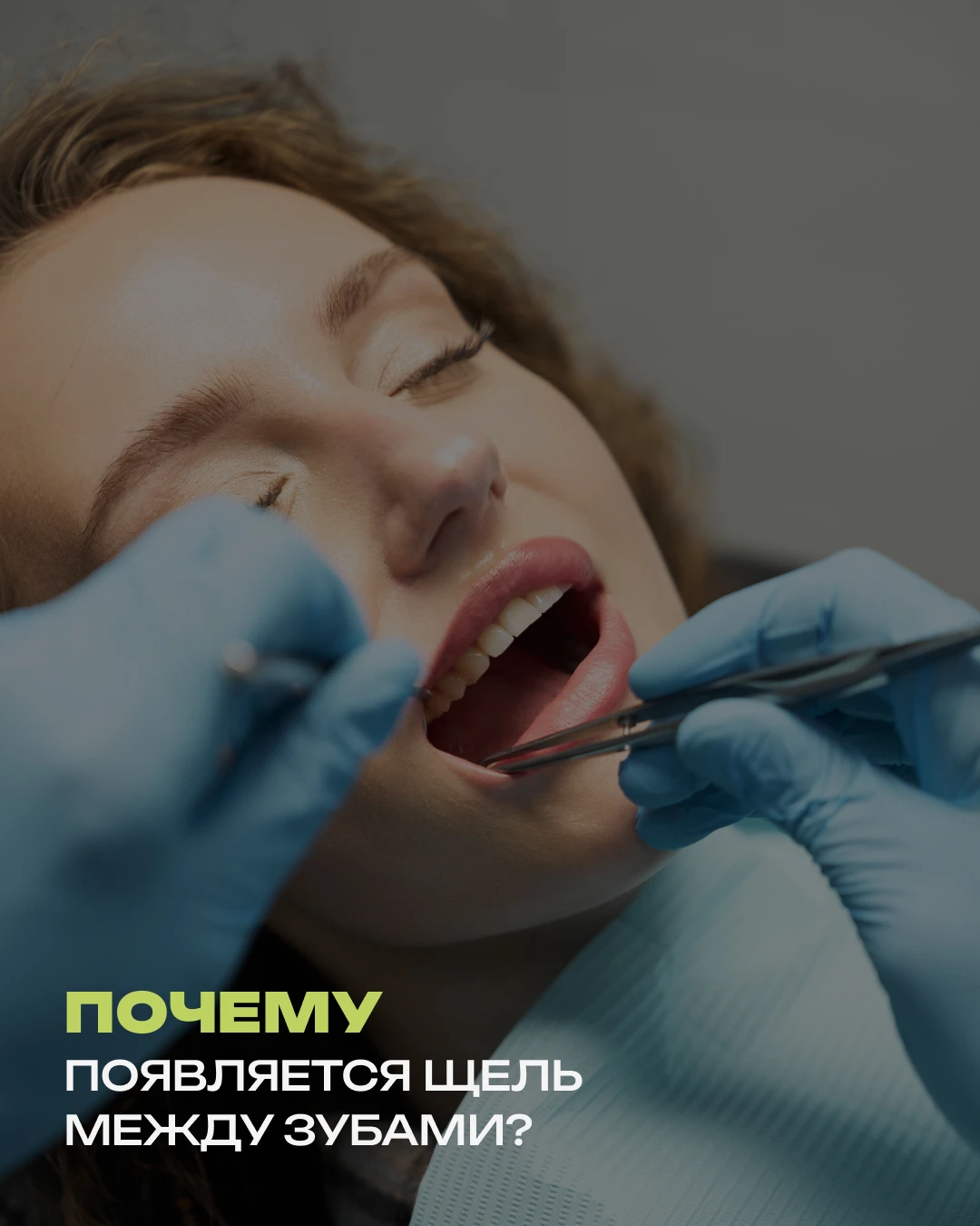 Между зубами появилась щель, которой раньше не было. Стоит ли волноваться? Небольшие пр...