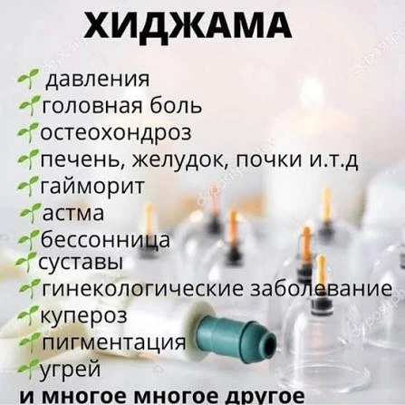 Хиджама - это сильная энергетическая практика. Она работает как с телесными, так и с пс...