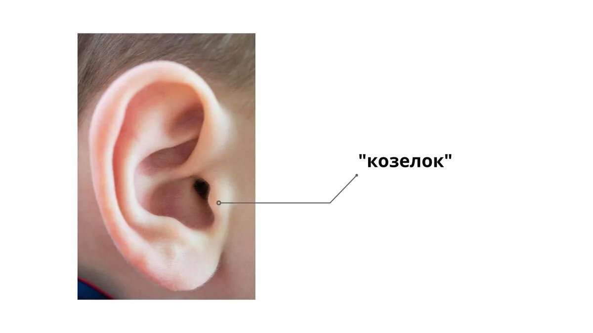 Посты про отит, для ответа на вопросы: