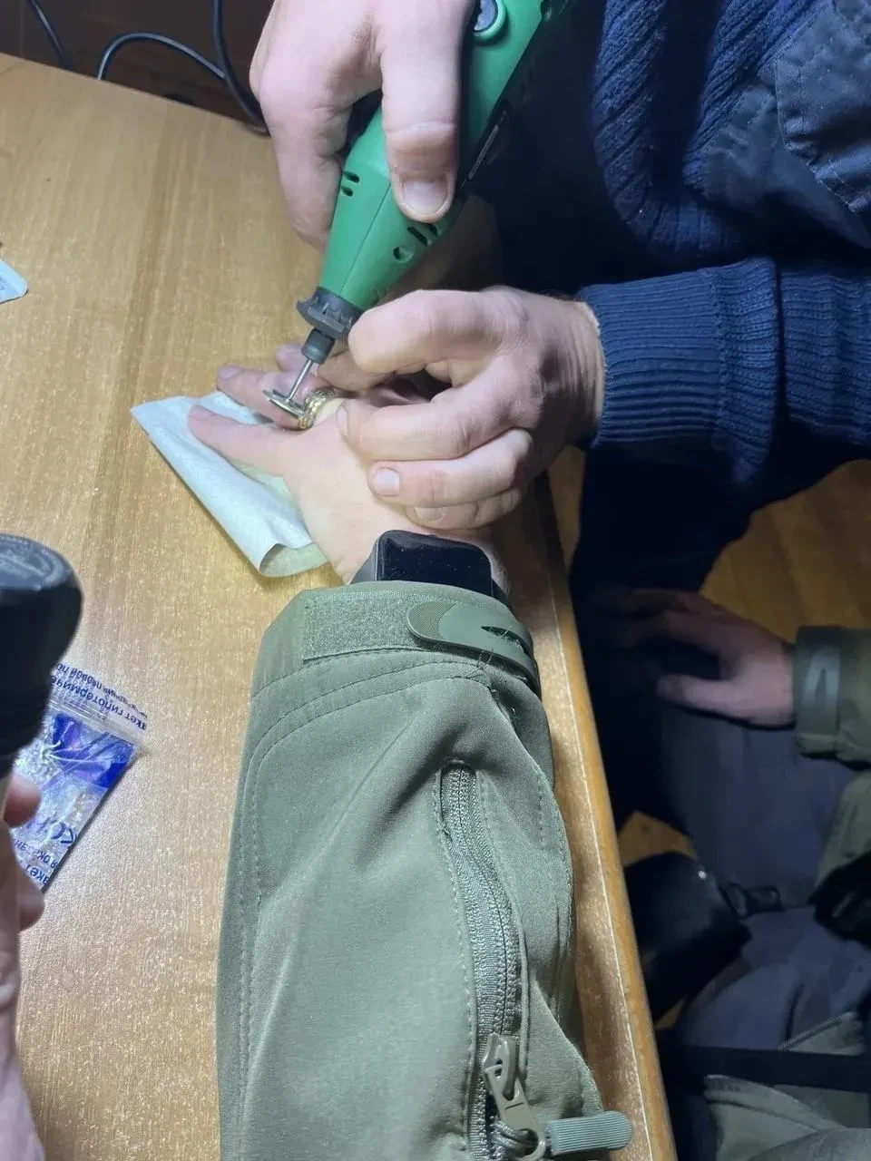 Спасатели сняли кольцо с отёкшего пальца