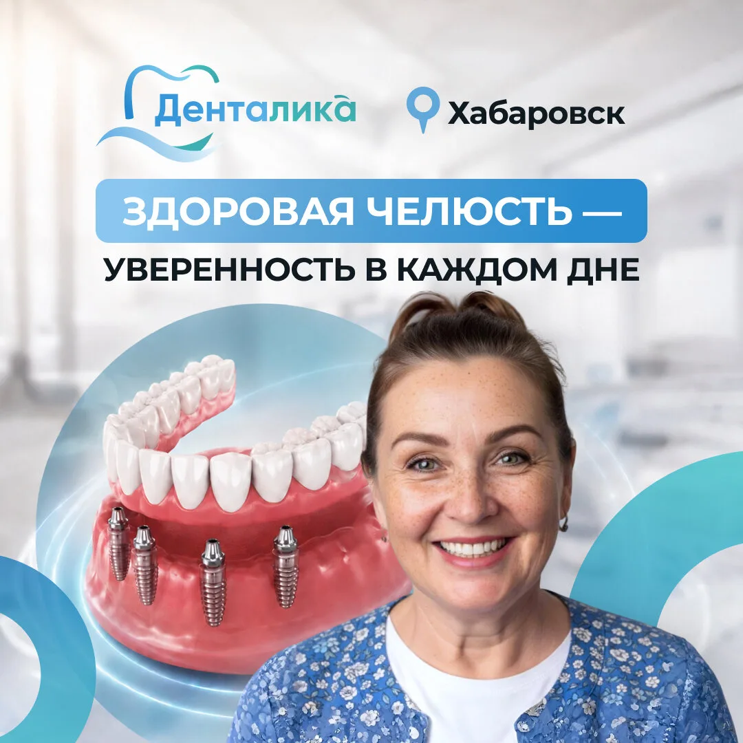 Полностью новые зубы на 4 имплантах за 1 день. Хабаровск