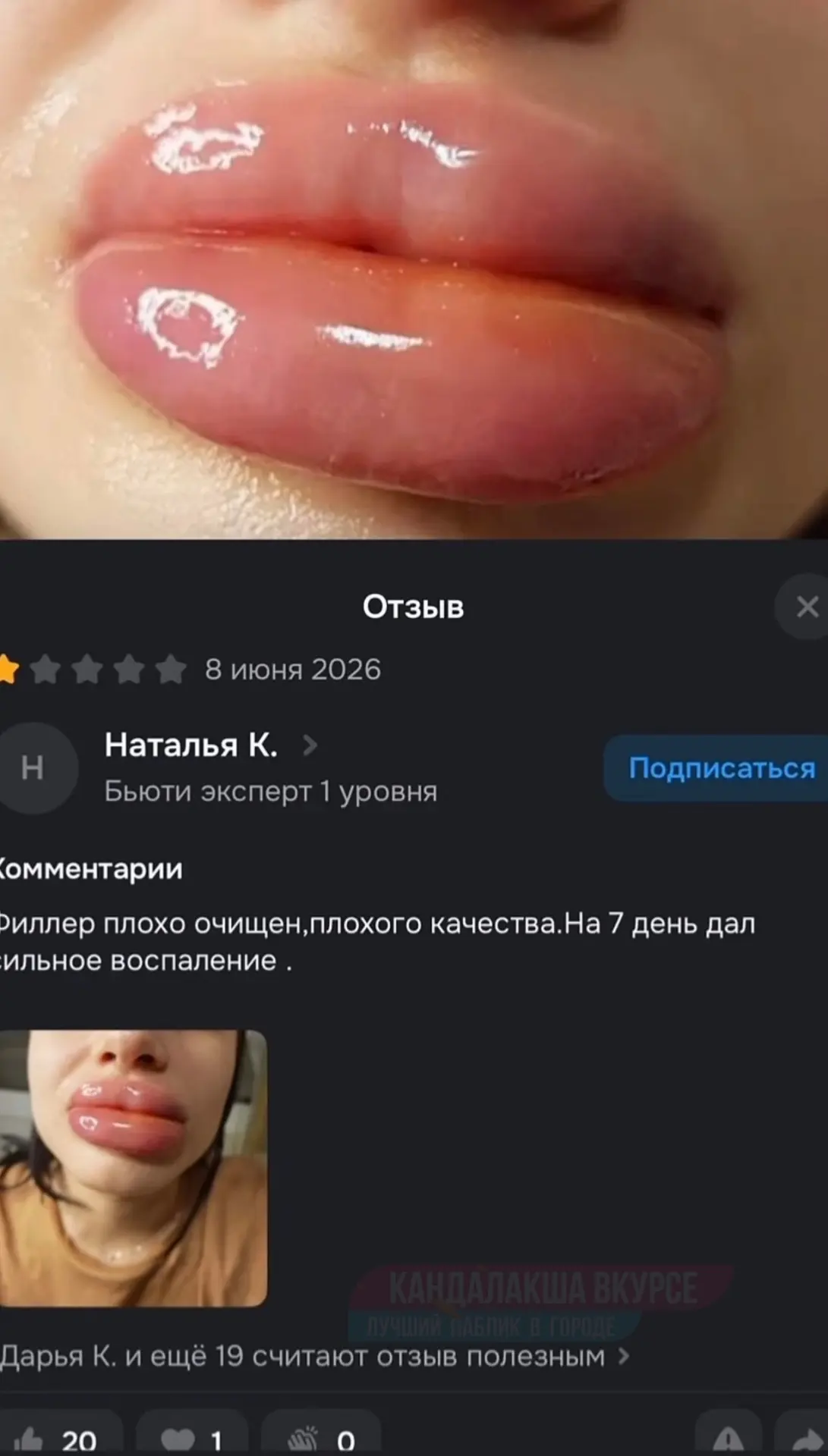 Девушки, кто пробовал покупать этот филлер? Правда плохо? А то это так деньги экономит,...