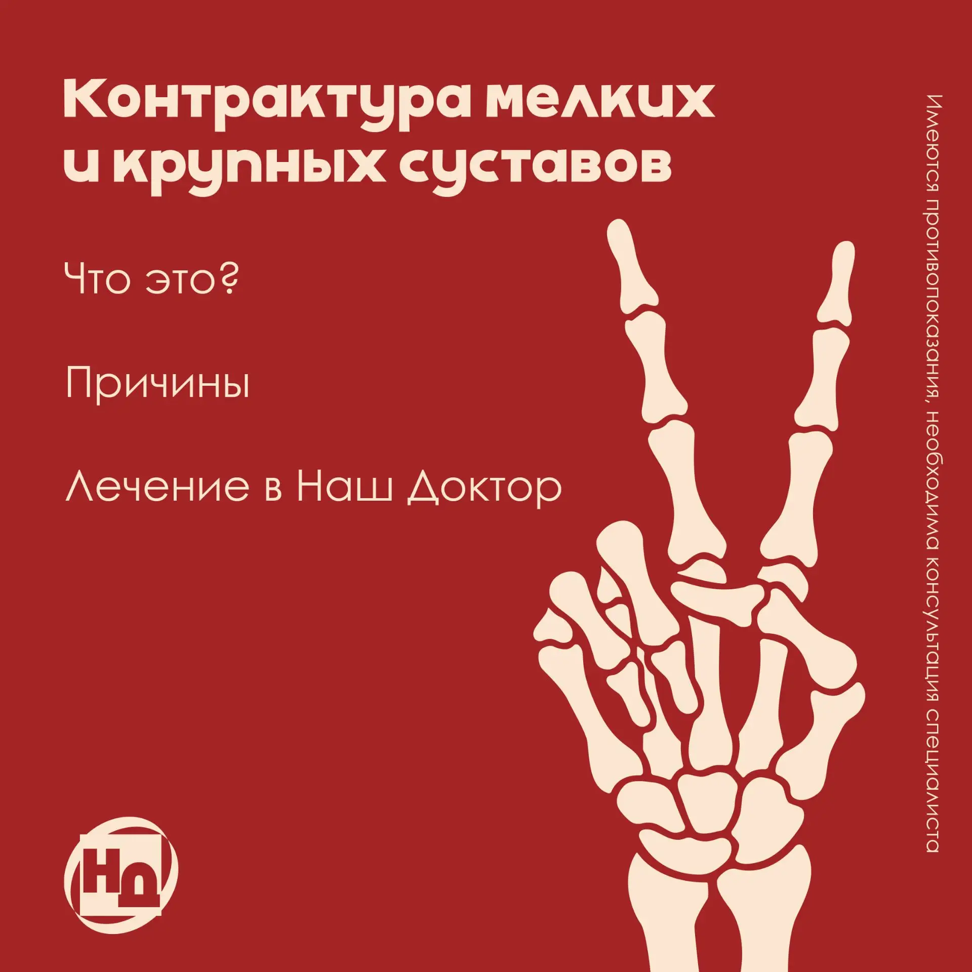 🦴 Контрактура мелких и крупных суставов: причины и лечение в «Наш Доктор»