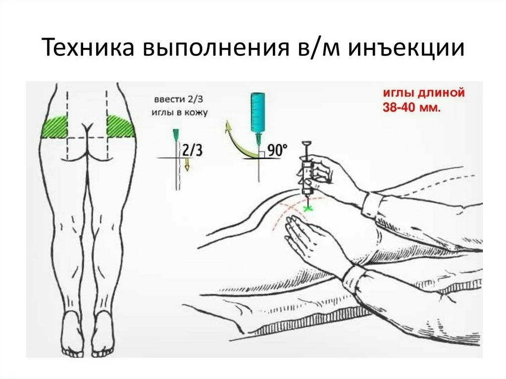 Как правильно делать инъекции? Сохраните! ✅