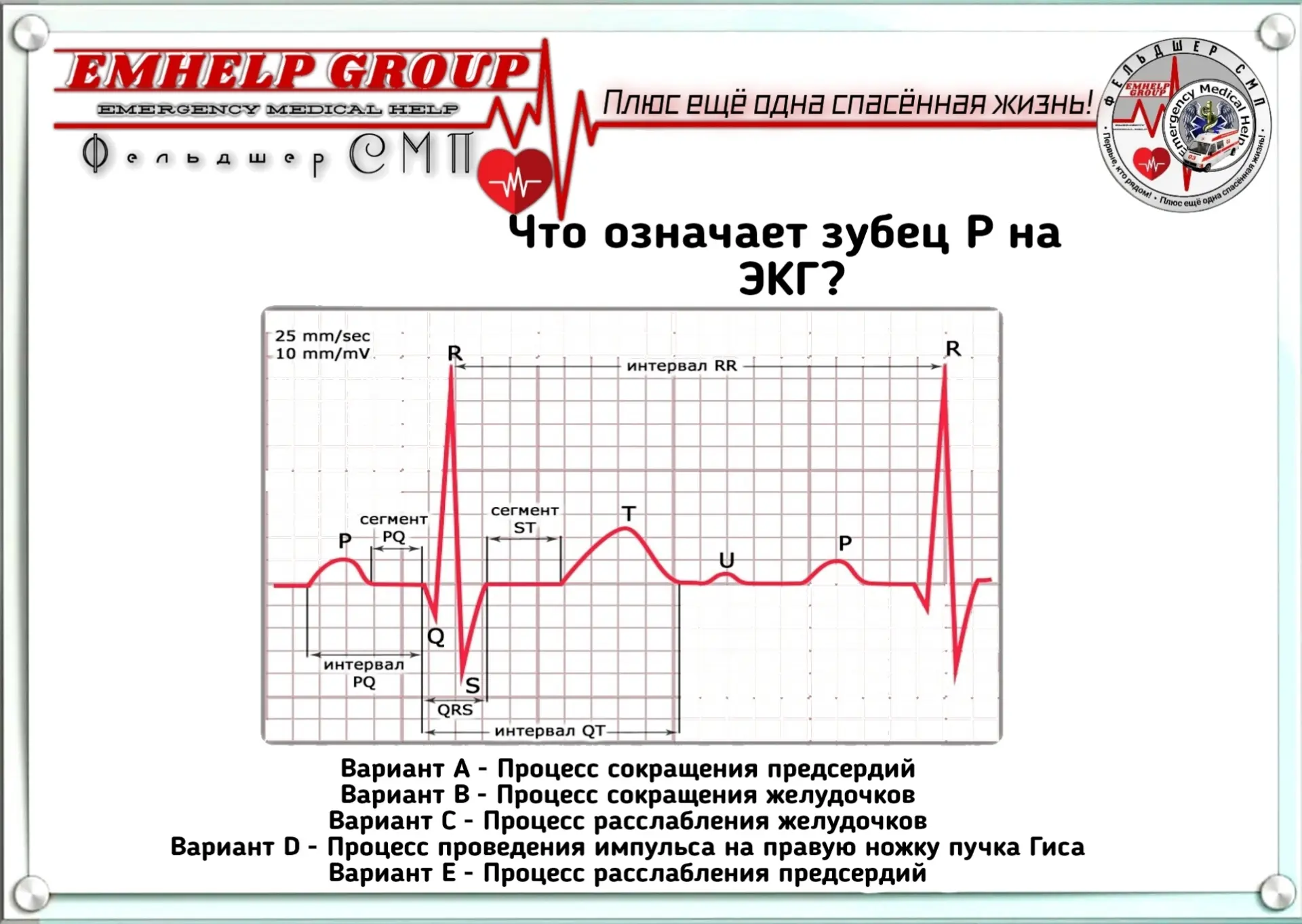 Что означает зубец Р на ЭКГ?