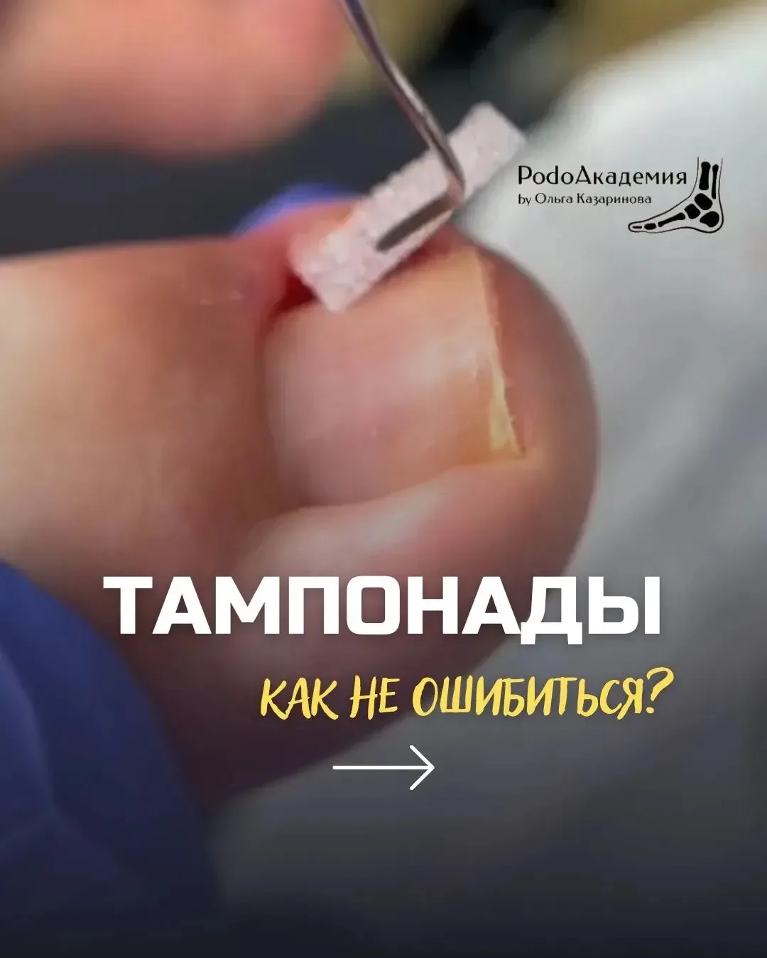 Казалось бы, тампонада.