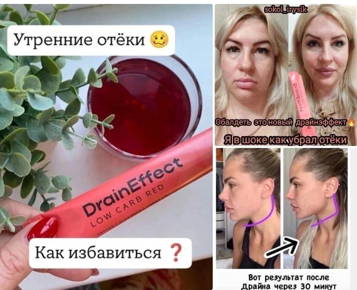 Отекаешь с утра ❓❓❓