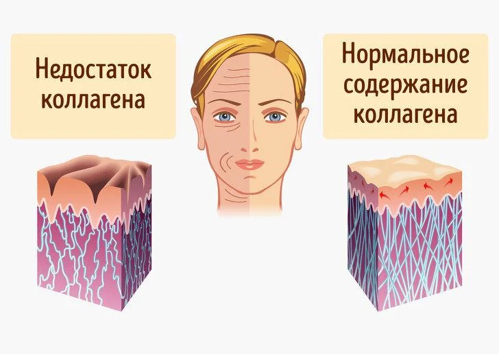 Увы. Это неизбежный биологический процесс