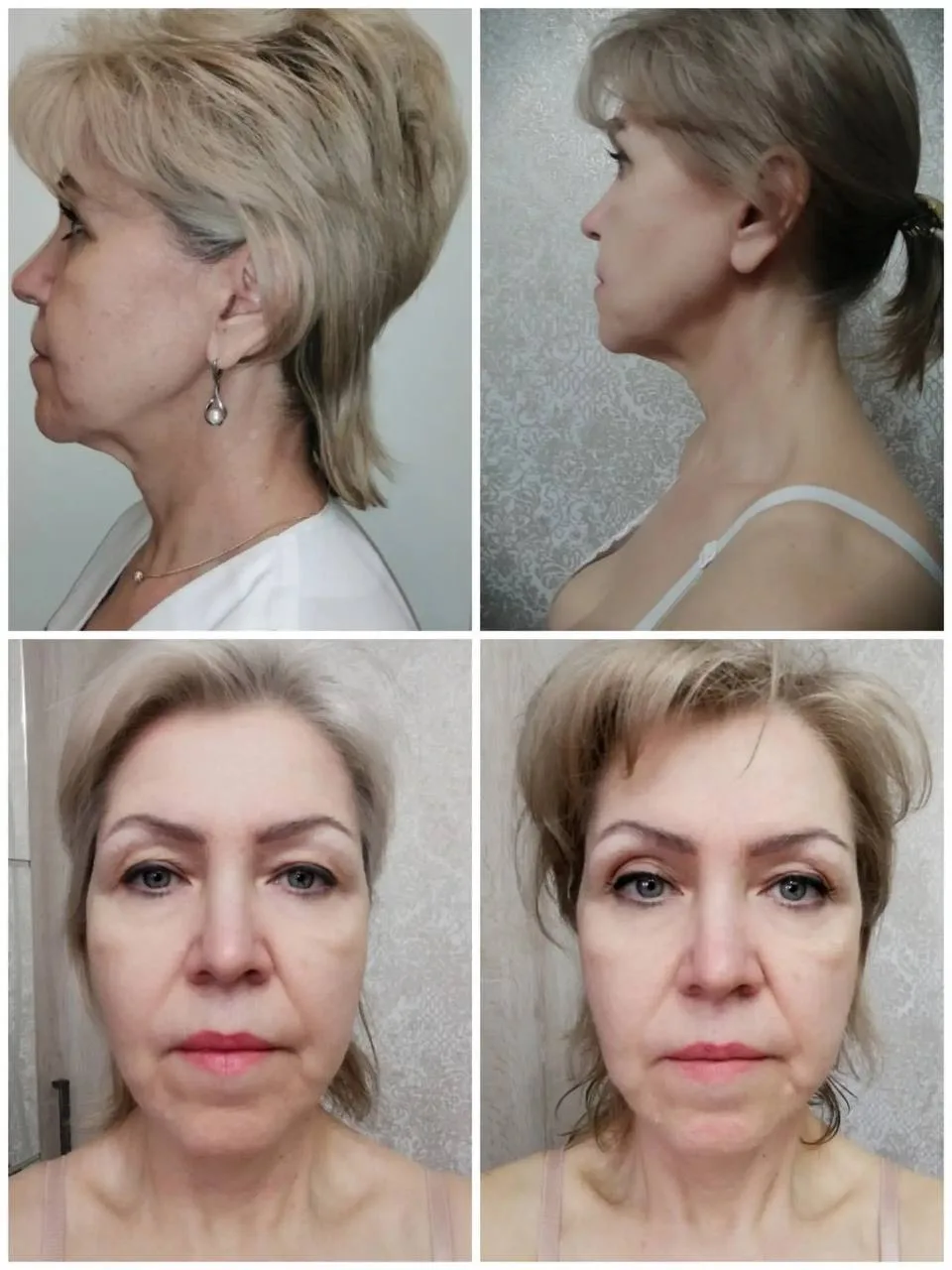 ⏱️ ПОЛЧАСА ГИМНАСТИКИ ДЛЯ ЛИЦА? А ЗАЧЕМ?