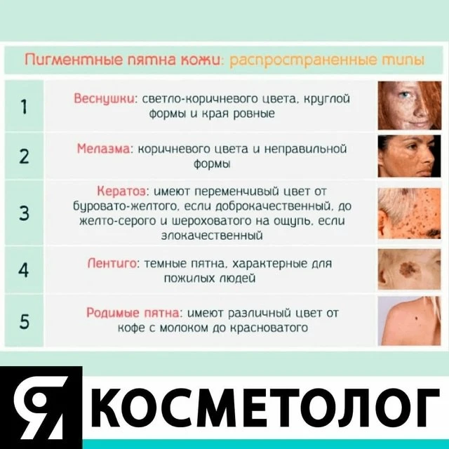 О ЧЕМ ГОВОРЯТ ПИГМЕНТНЫЕ ПЯТНА
