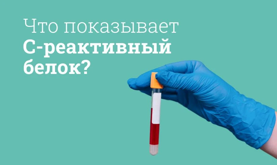 Высокий СРБ = срочно пить антибиотики? 🛑  НЕТ.