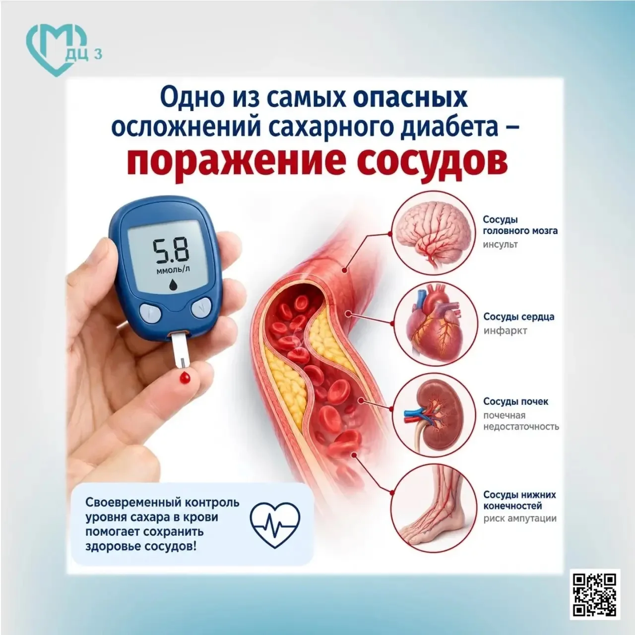 Одно из самых опасных осложнений сахарного диабета – поражение сосудов