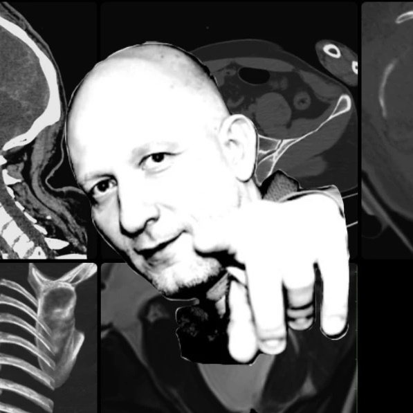 Логотип канала Русская радиология - Цориев Андрей Эльдарович